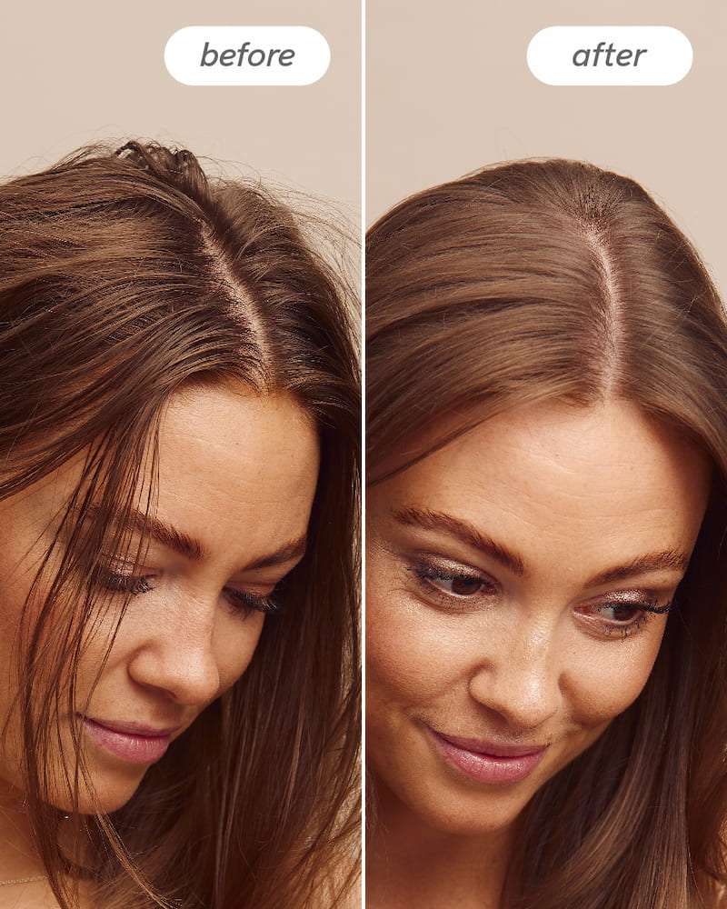 Scalp Delight™ Bundle - Image 9